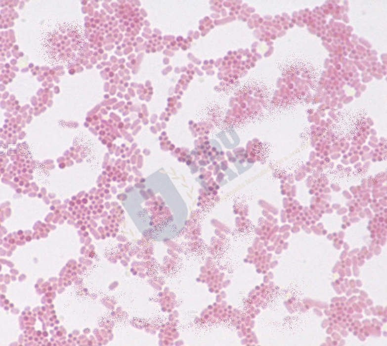 Escherichia Coli (400x)