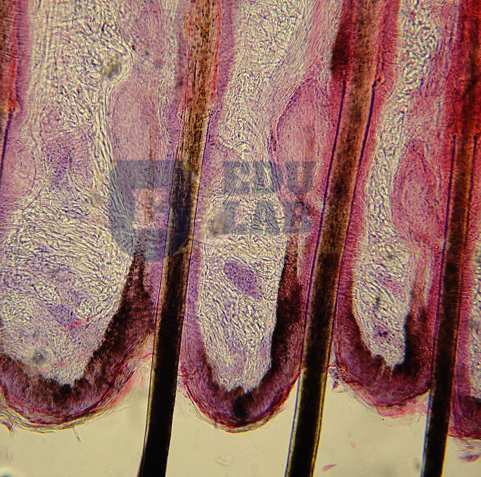 Skin and Hair Follicles (40x)